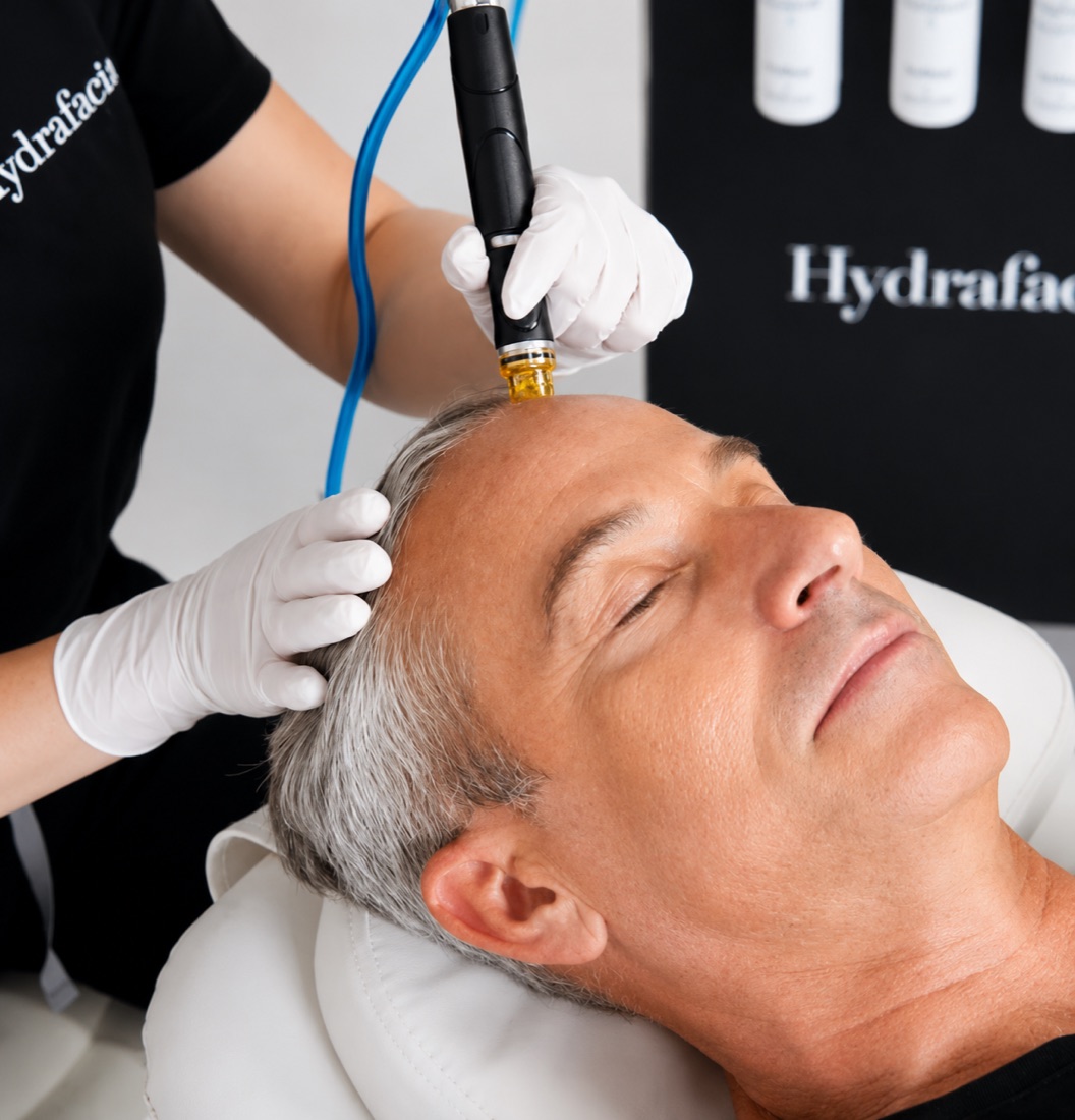 HydraScalp with Keravive treatment in progress, the HydraFacial handpiece worked along the hairline
